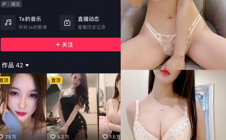抖音 夏天的小雪 微密圈 嘉宾专享 NO.020期 【24P】