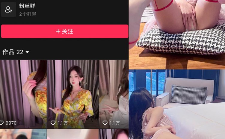 抖音 小小奶瓶儿 微密圈 NO.012期 【22P】