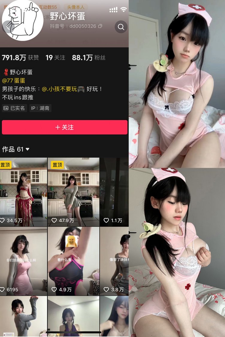 抖音 野心坏蛋 微密圈 NO.005期 【22P28V】