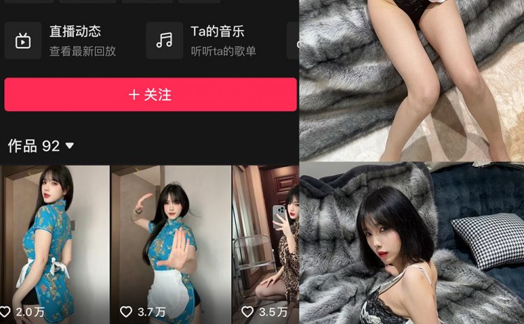 抖音 琳铛 微密圈 NO.082期 【37P】最新至：2025.2.8